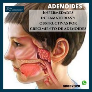 Adenoides y enfermedades inflamatorias.