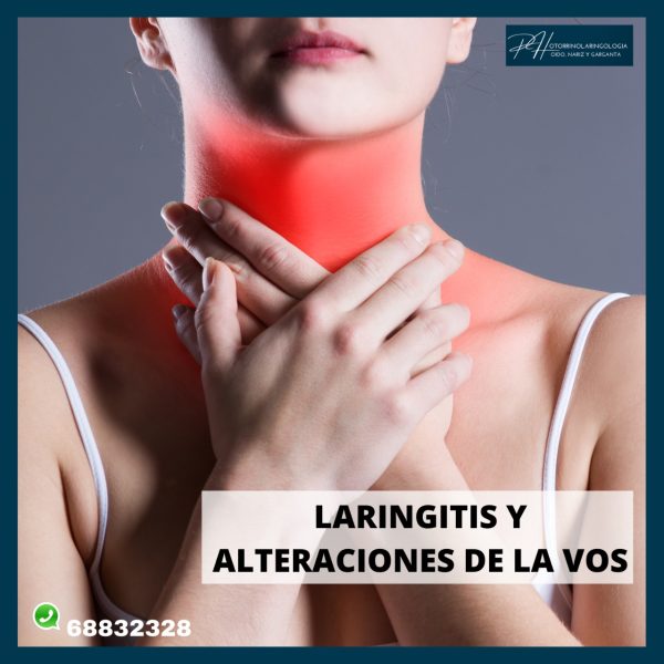 Laringitis y alteraciones de la vos.