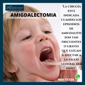 Amigdalectomia.